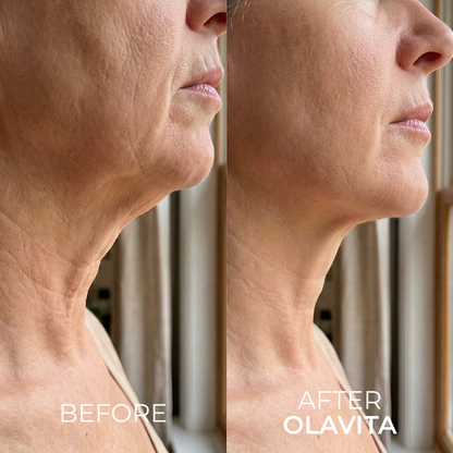 The Korean Needle-Free Toxin for Visibly Firmer, Smoother, And More Radiant Skin — Anywhere It Ages