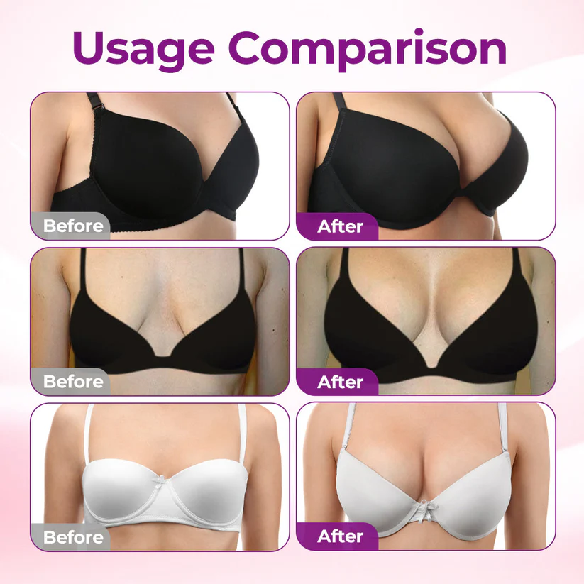 💥TopSpire® 💥Targeted Breast Enhancement Advanced Nano Microneedle Patch💥💥💥