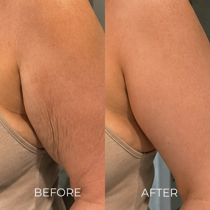 The Korean Needle-Free Toxin for Visibly Firmer, Smoother, And More Radiant Skin — Anywhere It Ages