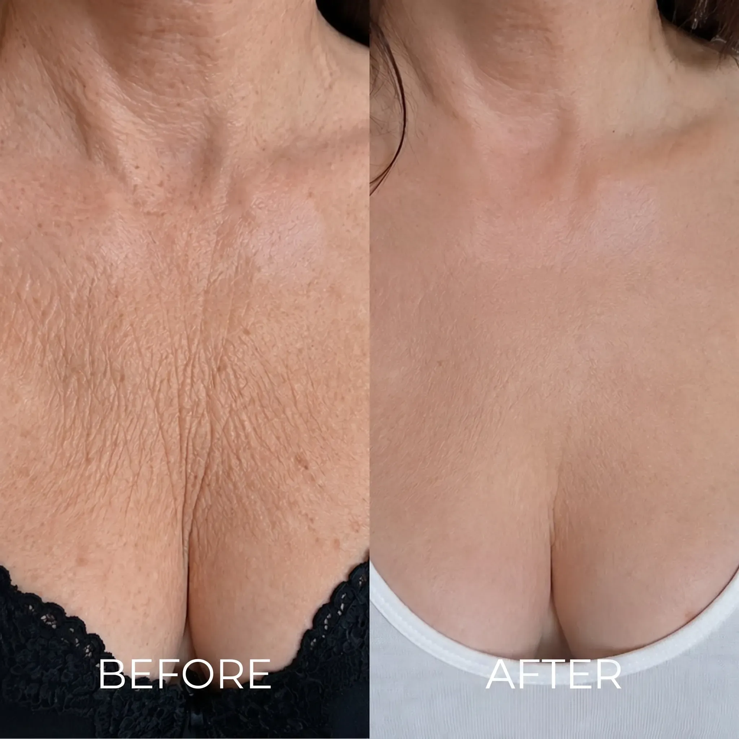 The Korean Needle-Free Toxin for Visibly Firmer, Smoother, And More Radiant Skin — Anywhere It Ages