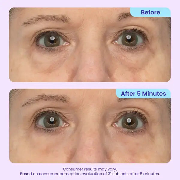 TopSpire Eye Bag Instant Eraser, Tightens, Firms, & Blurs Wrinkles