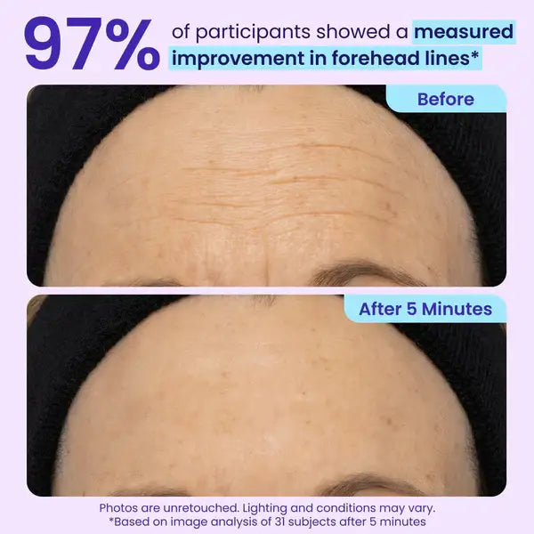 TopSpire Eye Bag Instant Eraser, Tightens, Firms, & Blurs Wrinkles
