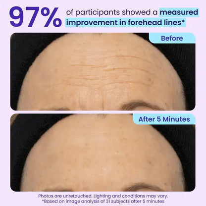 TopSpire Eye Bag Instant Eraser, Tightens, Firms, & Blurs Wrinkles