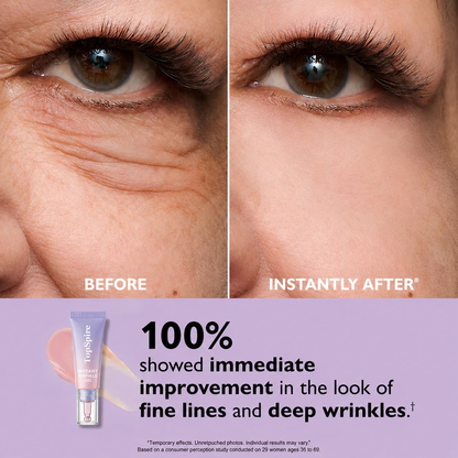 TopSpire Eye Bag Instant Eraser, Tightens, Firms, & Blurs Wrinkles