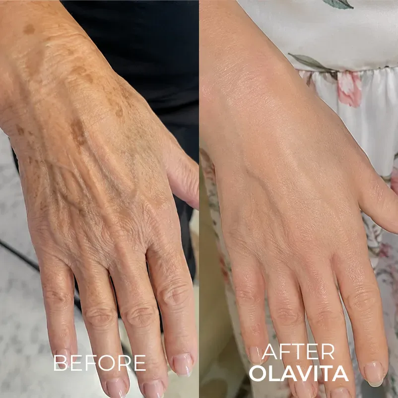 The Korean Needle-Free Toxin for Visibly Firmer, Smoother, And More Radiant Skin — Anywhere It Ages