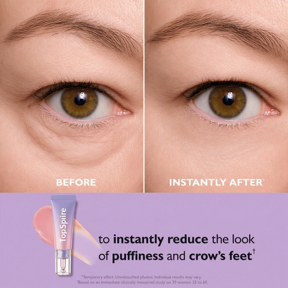 TopSpire Eye Bag Instant Eraser, Tightens, Firms, & Blurs Wrinkles